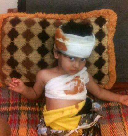 الطفلة المصابة رغد - تصوير:محمد الشرعبي